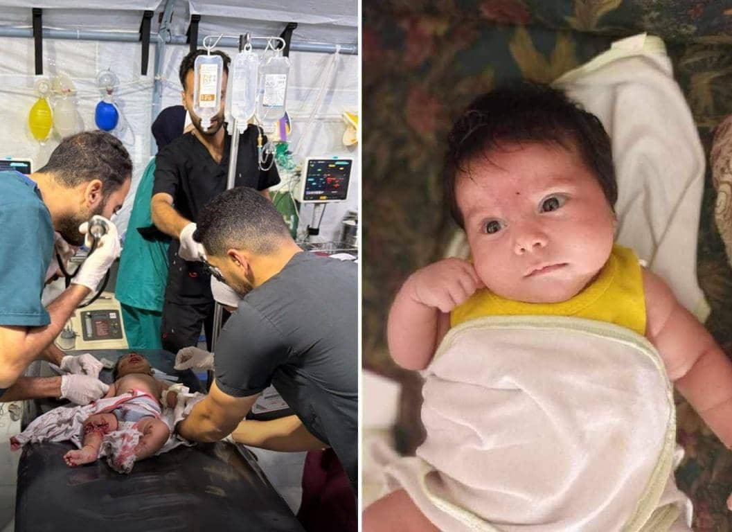Medical professionals care for an injured baby in a makeshift clinic while another image shows the baby. The content relates to donating crypto for Palestine humanitarian aid, including medical care and food packages.