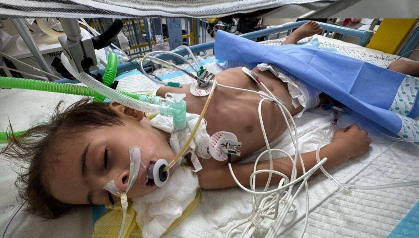 A child hooked up to medical equipment in a hospital bed, needing urgent aid and relief in Gaza. Your crypto donations, like XLM, can provide life-saving sustenance and medical supplies.