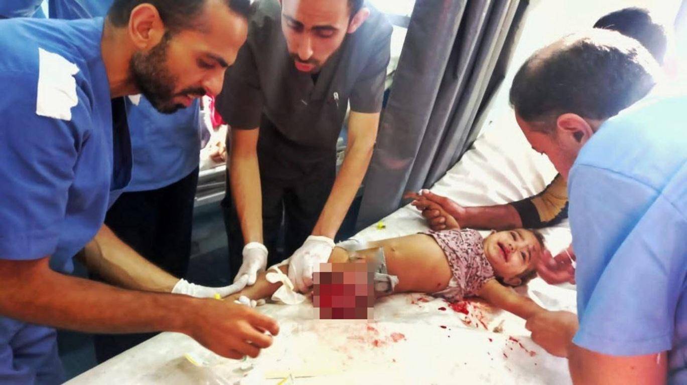 Medical professionals tending to injured child in Gaza, receiving aid via crypto donations like BTC.