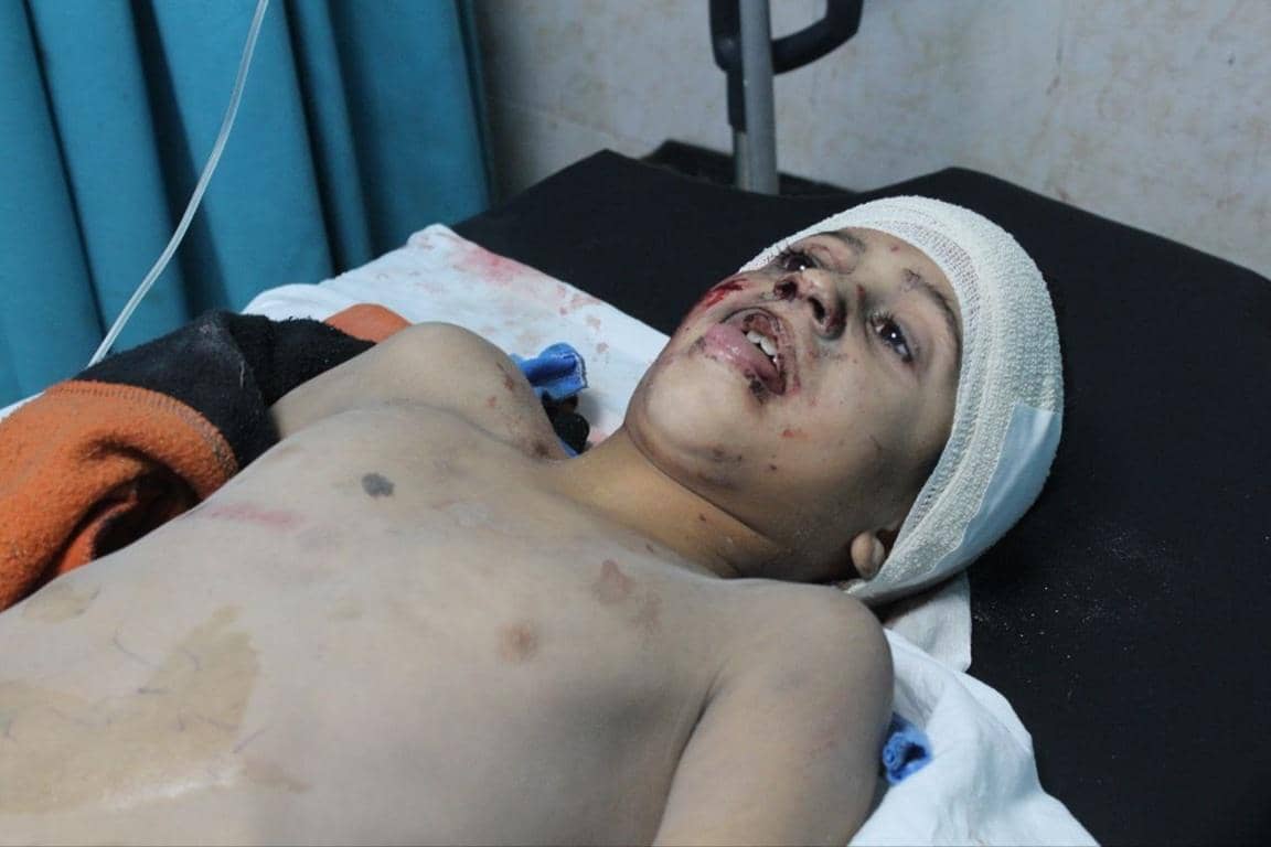 Injured child lies on a medical bed, receiving aid for Gaza, supported by crypto donations through BNB for life-saving medical supplies and Zakat.