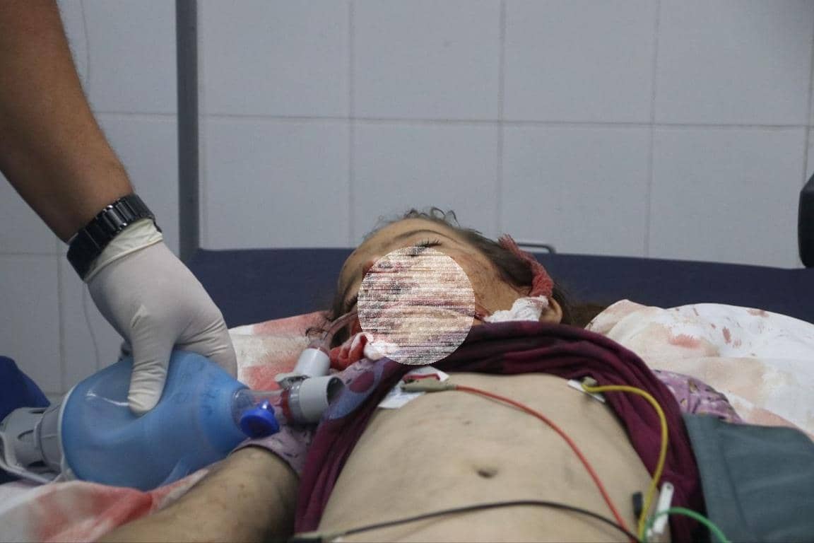 Medical professional in gloves administers aid with a bag-valve mask to a child needing critical care. Supporting relief efforts with ETH donations.