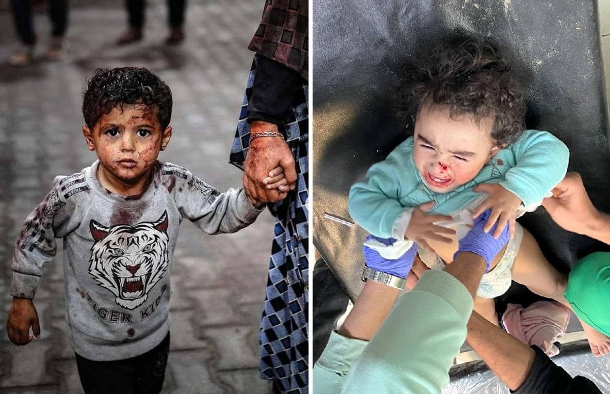 Two split images showing children in distress. On the left, a young boy with blood on his face and shirt holds a hand, possibly his mother's. On the right, a toddler with a bloody nose cries while medical personnel attend to them. This image highlights the urgent need for general healthcare and child support, made possible by crypto donations like BTC.