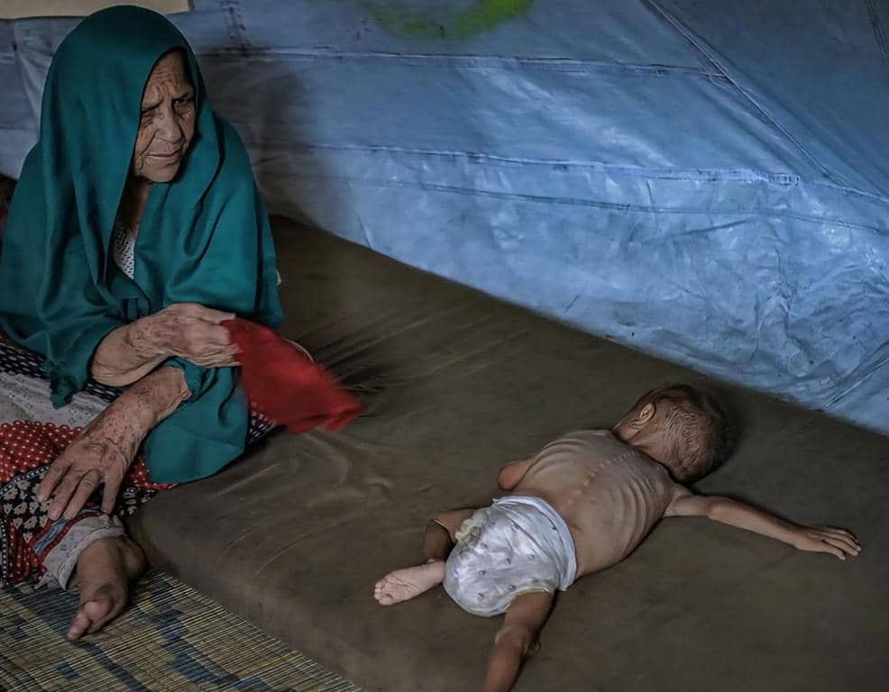 An elderly woman in a headscarf looks distressed as a severely emaciated child lies on a mat in a makeshift shelter, highlighting the urgent humanitarian crisis in Gaza. Your crypto aid, like ETH, provides vital sustenance.