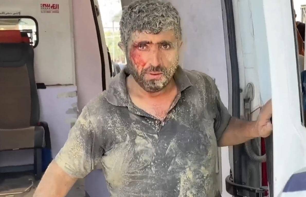 A dust-covered man with a bloody face looks out from an aid vehicle, symbolizing Yemen relief efforts and the urgent need for aid, supported by crypto via ETH.