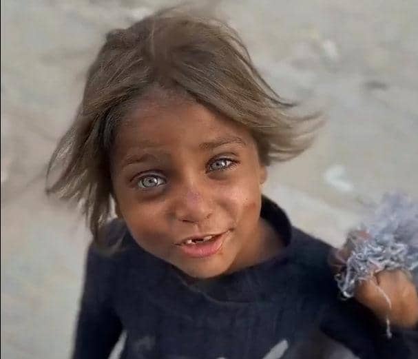 A child with striking blue eyes looks toward the camera, with dusty skin and wispy hair. Their plea for help is amplified by the support of crypto donations, powered by SOL.