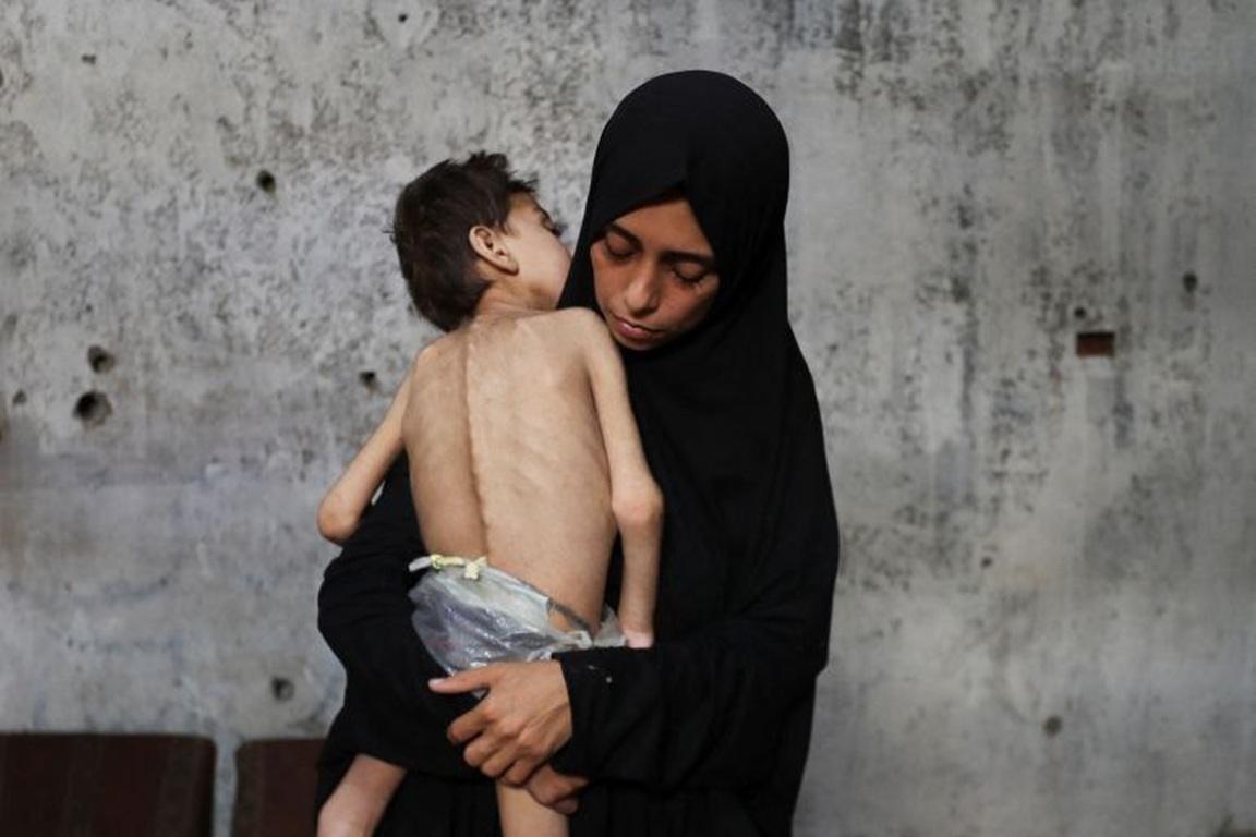 Woman in black hijab holding a severely emaciated child, crying for relief and sustenance. Aid supports Kaffarah payments via Tether. Feeding the needy in crisis-hit regions.