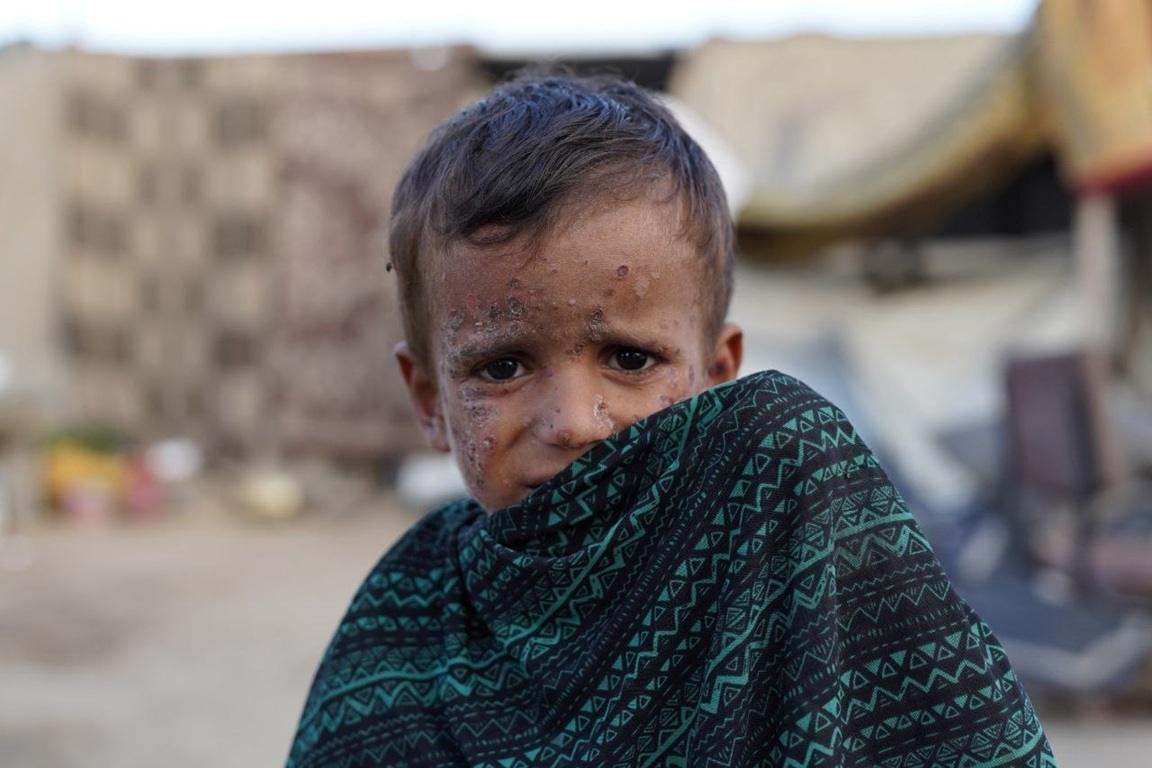 Anonymous crypto donation helps sick child in refugee camp. Send USDT to provide medical care and humanitarian relief.