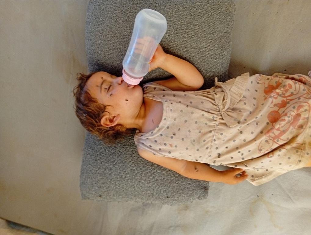 Malnourished refugee child drinks clean water via aid to combat Gaza disease outbreaks using USDC for urgent medical relief.