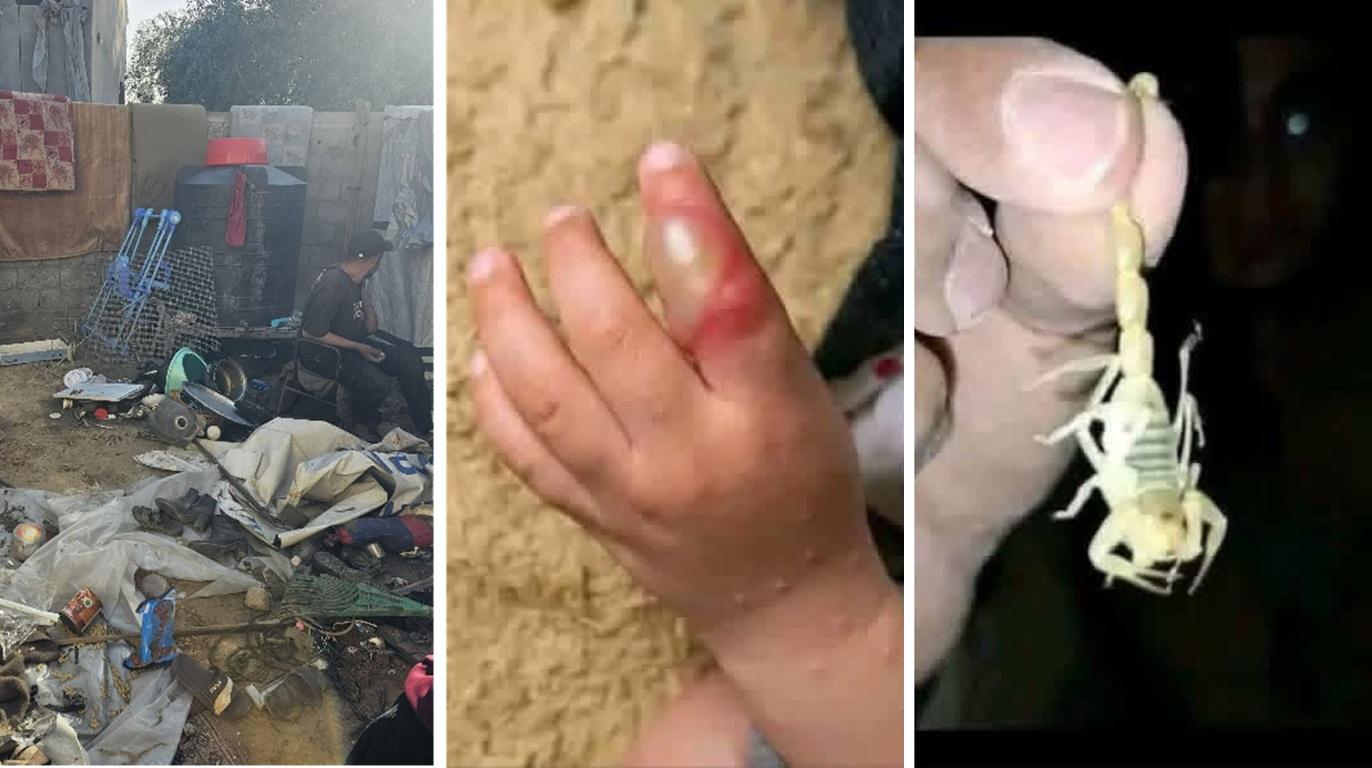 Gaza summer diseases impact showing camp waste, skin infection, and scorpion threat. Donate Stablecoin for relief and medicine.