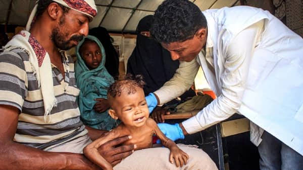 A thin child cries while a doctor examines them, aided by humanitarian crypto donations in Yemen. These essential health donations support medical aid and child health programs, provided by IslamicDonate Charity