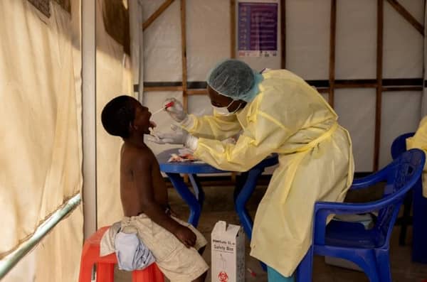 Medical professional in protective gear takes a swab sample from a child's mouth to test for mpox, supporting crypto donations via BTC for community health.